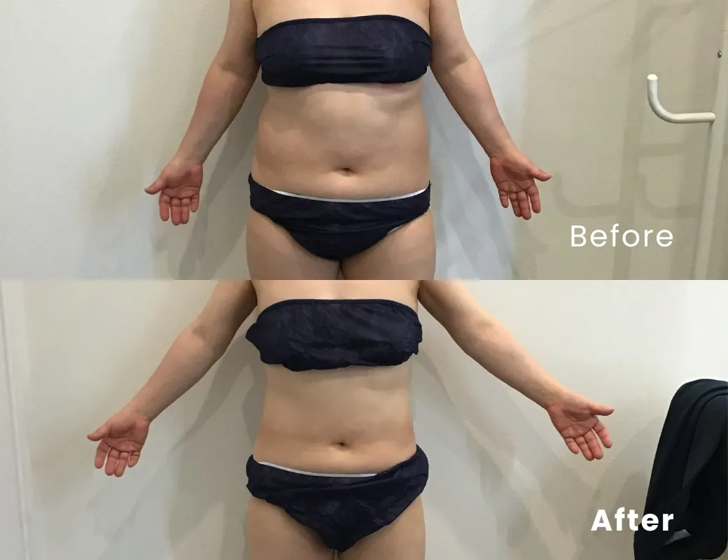 70.8kg→58.6kg