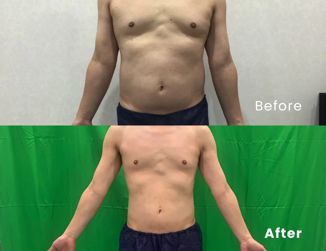 96.1kg→75.8kg