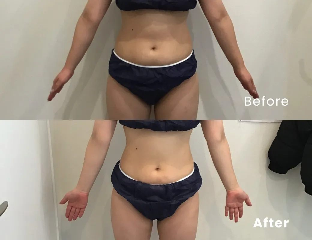 61.9kg→55.9kg